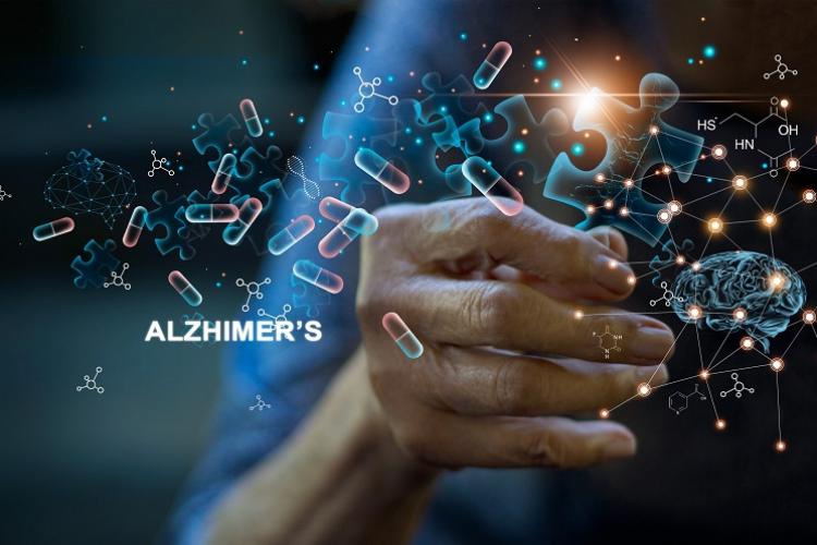 Alzheimer's Disease